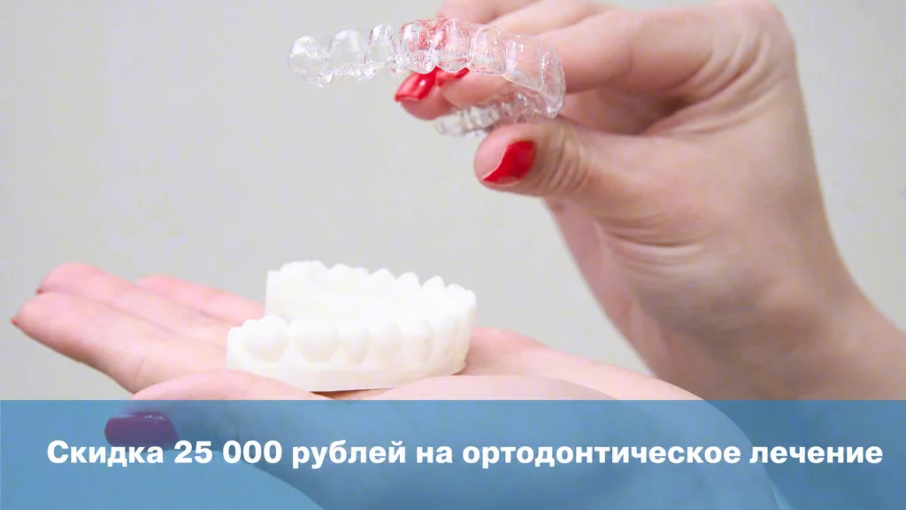 Скидка 25 000 руб. на ортодонтическое лечение